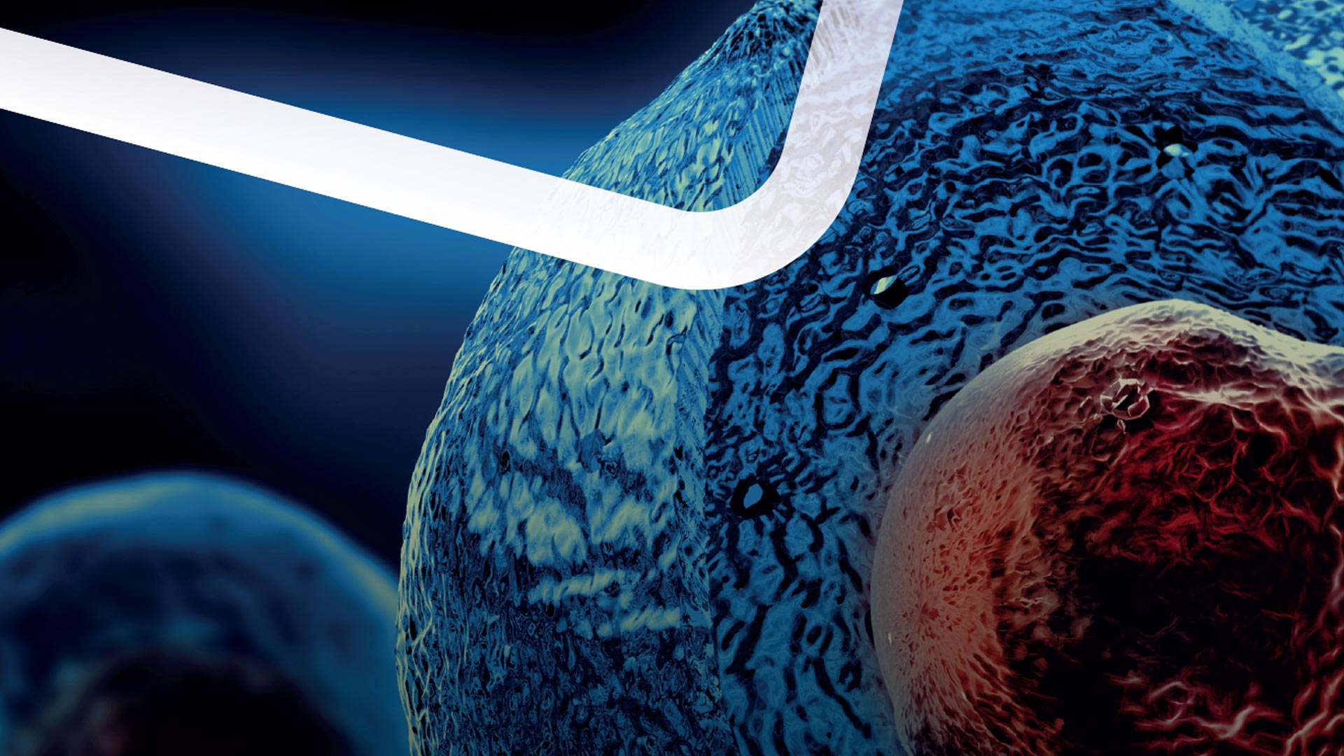 Kök Hücre Tedavisi